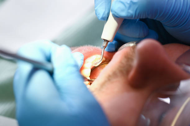 Best Affordable Emergency Dental Care  in Ridge Manor, FL