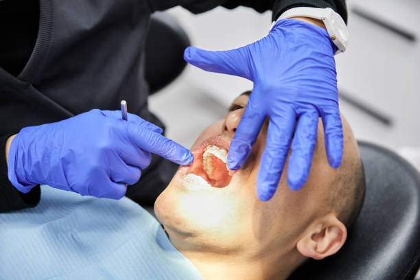 Best Dentist for Tooth Abscess  in Ridge Manor, FL