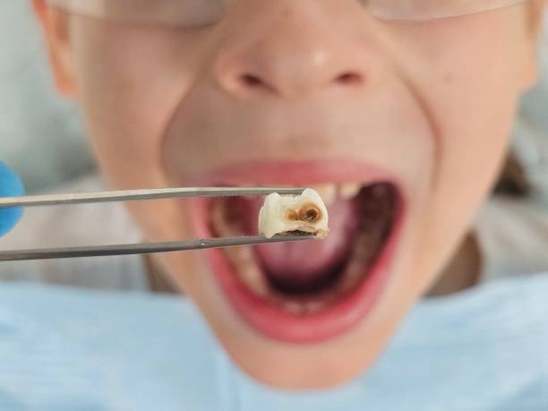 Best Teeth Whitening  in Ridge Manor, FL